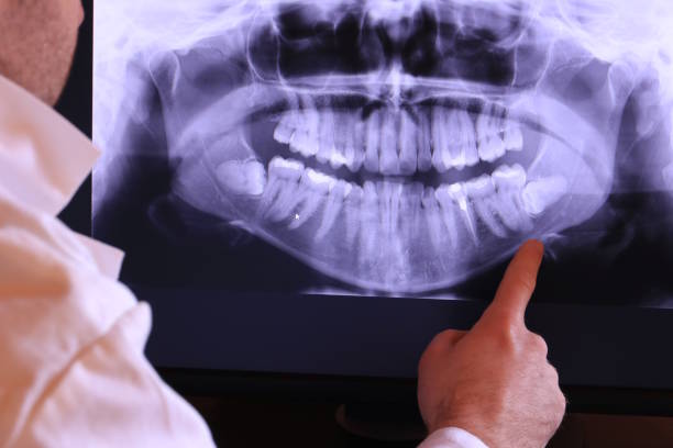 Best Emergency Tooth Extraction in Big Rapids, MI